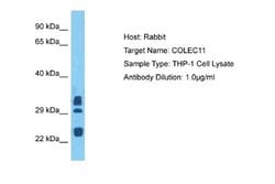 CL-K1/COLEC11 Rabbit anti-Human, Polyclonal, Novus Biologicals 0.1 mL | Buy Online | Novus Biologicals | Fisher Scientific